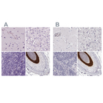 KRT25 Antibody in Immunohistochemistry (Paraffin) (IHC (P))