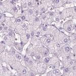 KRT25 Antibody in Immunohistochemistry (Paraffin) (IHC (P))