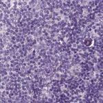 KRT25 Antibody in Immunohistochemistry (Paraffin) (IHC (P))