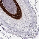 KRT25 Antibody in Immunohistochemistry (Paraffin) (IHC (P))