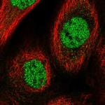 CHRAC1 Polyclonal Antibody