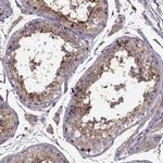 SLC52A3 Polyclonal Antibody