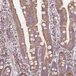 HINT2 Antibody in Immunohistochemistry (Paraffin) (IHC (P))