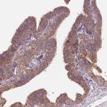 HINT2 Antibody in Immunohistochemistry (Paraffin) (IHC (P))