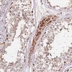 HINT2 Antibody in Immunohistochemistry (Paraffin) (IHC (P))