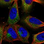 Clathrin Heavy Chain Polyclonal Antibody