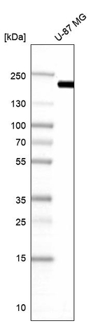 Clathrin Heavy Chain Antibody in Western Blot (WB)