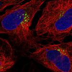 TM9SF1 Polyclonal Antibody