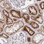 TM9SF1 Antibody in Immunohistochemistry (Paraffin) (IHC (P))