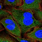 EAP30 Polyclonal Antibody