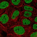 PBRM1 Antibody in Immunocytochemistry (ICC/IF)