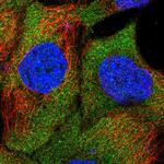 SAMD4B Polyclonal Antibody