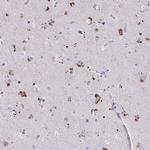 WDR97 Polyclonal Antibody