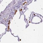 Tartrate Resistant Acid Phosphatase Antibody in Immunohistochemistry (Paraffin) (IHC (P))