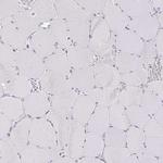 Tartrate Resistant Acid Phosphatase Antibody in Immunohistochemistry (Paraffin) (IHC (P))