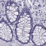 RNase12 Antibody in Immunohistochemistry (Paraffin) (IHC (P))