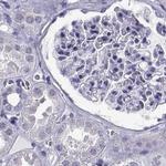 RNase12 Antibody in Immunohistochemistry (Paraffin) (IHC (P))