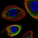 Cytokeratin 5 Antibody in Immunocytochemistry (ICC/IF)