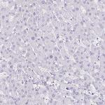 Cytokeratin 5 Antibody in Immunohistochemistry (Paraffin) (IHC (P))