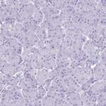 Cytokeratin 5 Antibody in Immunohistochemistry (Paraffin) (IHC (P))