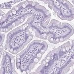 Cytokeratin 5 Antibody in Immunohistochemistry (Paraffin) (IHC (P))