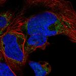 NDUFA10 Antibody in Immunocytochemistry (ICC/IF)