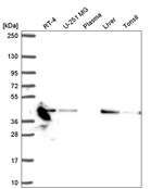 NDUFA10 Antibody in Western Blot (WB)