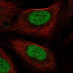 PHAX Polyclonal Antibody