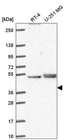 PHAX Antibody in Western Blot (WB)
