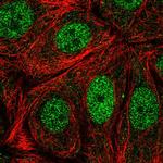 CDK10 Polyclonal Antibody