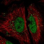 NIP30 Polyclonal Antibody