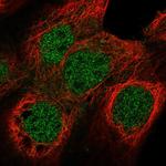 NUF2 Polyclonal Antibody