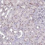 PUF60 Antibody in Immunohistochemistry (Paraffin) (IHC (P))