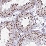 PUF60 Antibody in Immunohistochemistry (Paraffin) (IHC (P))