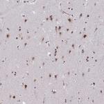 PUF60 Antibody in Immunohistochemistry (Paraffin) (IHC (P))