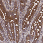 MYO19 Antibody in Immunohistochemistry (Paraffin) (IHC (P))