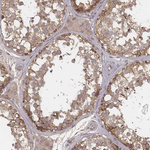 MYO19 Antibody in Immunohistochemistry (Paraffin) (IHC (P))