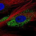 COL1A2 Polyclonal Antibody