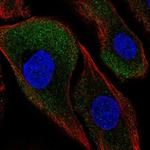 CAPNS2 Polyclonal Antibody