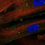 Thrombospondin 1 Polyclonal Antibody