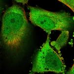 GLO1 Polyclonal Antibody