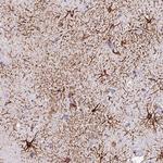 ECM29 Polyclonal Antibody