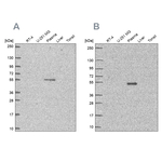 EED Antibody in Western Blot (WB)