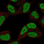 ZNF306 Polyclonal Antibody