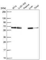ACOT2 Antibody in Western Blot (WB)