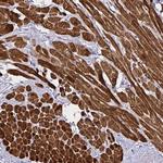 PGAM2 Antibody in Immunohistochemistry (Paraffin) (IHC (P))