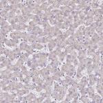 PGAM2 Polyclonal Antibody