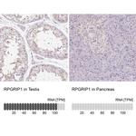 RPGRIP1 Antibody