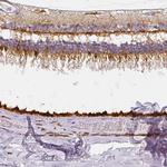 RPGRIP1 Antibody in Immunohistochemistry (Paraffin) (IHC (P))