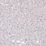 RPGRIP1 Antibody in Immunohistochemistry (Paraffin) (IHC (P))